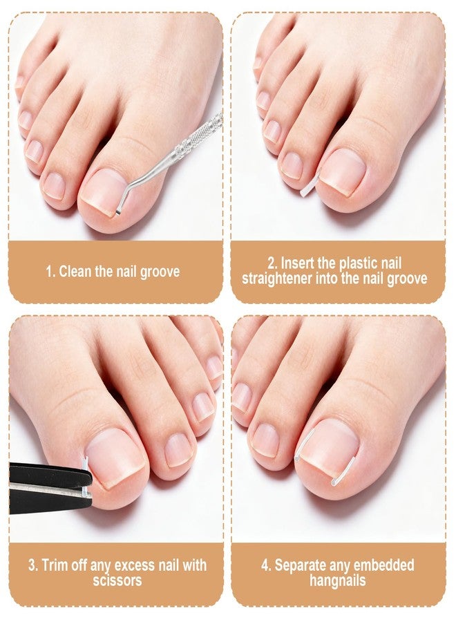 Sinbana 16pcs Ingrown Toenail Kit, with Breathable In-Growing Toenail Strips Curved Toes Correction Plaster Patches Painless File and Lifting Pedicure Tools for Women Men - Image 5